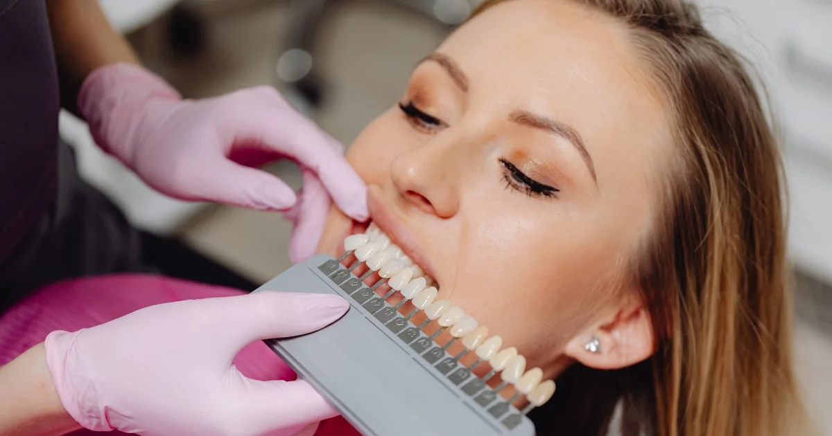 Composite Bonding vs Veneers - Which Is Right for Your Smile?