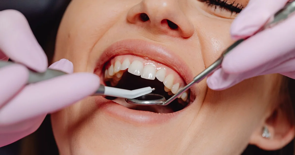 Gum Contouring and Gummy Smile Treatment - Is It Right for You?
