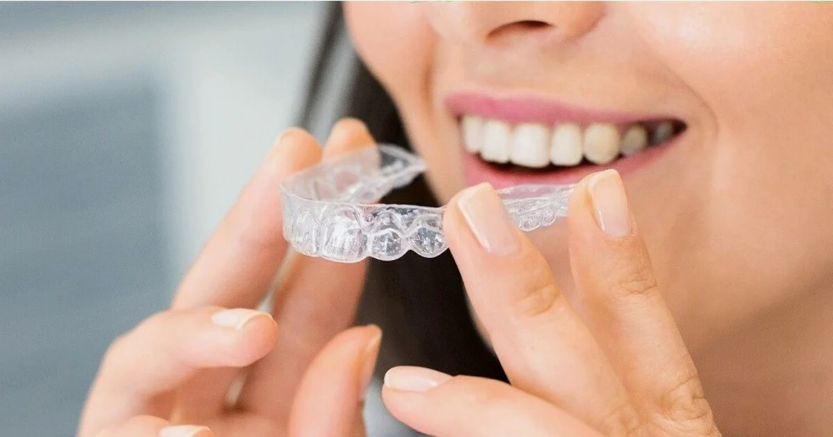 Invisalign for Adults - Is It Worth It? A Complete Guide for Western Sydney