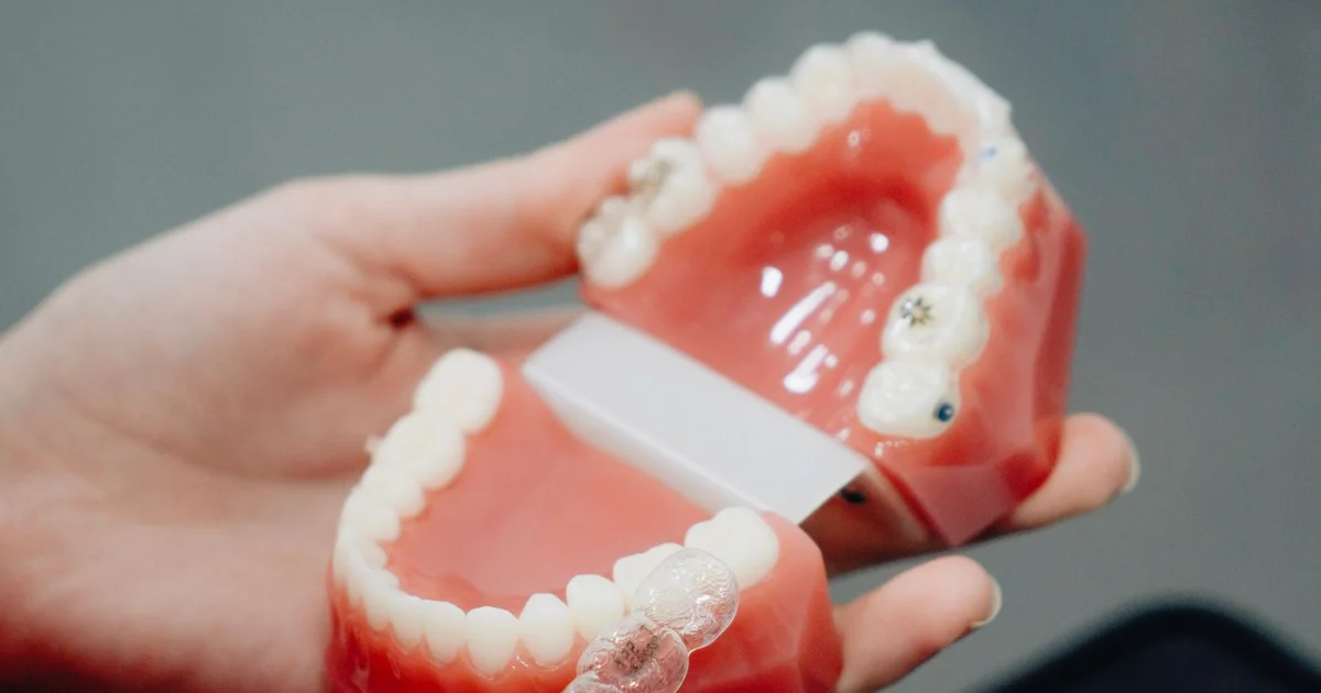 Invisalign vs Braces - Which Is Right for You?
